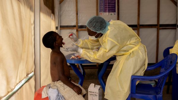Mpox Congo